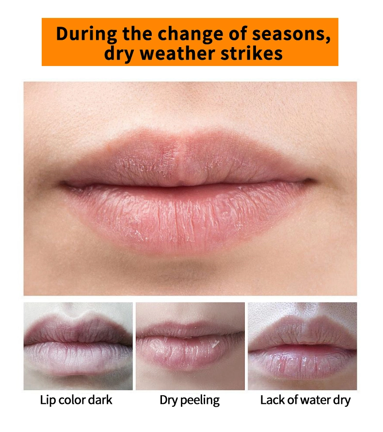 Improves The Lip Wrinkles Collagen Moisturizing Lip Care