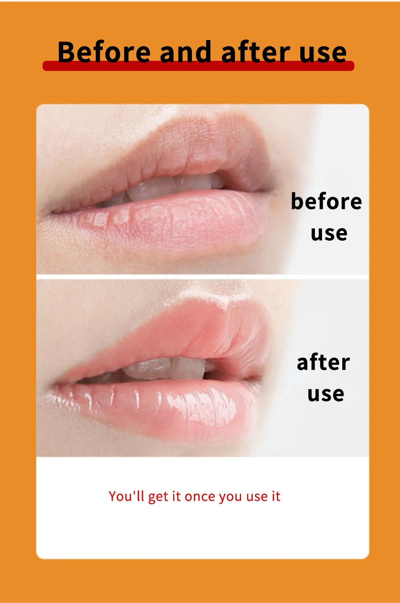 Improves The Lip Wrinkles Collagen Moisturizing Lip Care